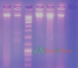 بررسی کیت اسخراج DNA از بزاق ژن و پرایم